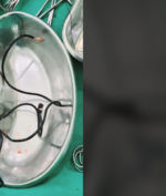 Kabel Charger Ditemukan Dalam Tubuh Manusia, Apakah Dia Robocop?