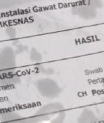 Surat PCR Positif Covid-19 Jadi Bungkus Gorengan, Kini Diselidiki Polisi