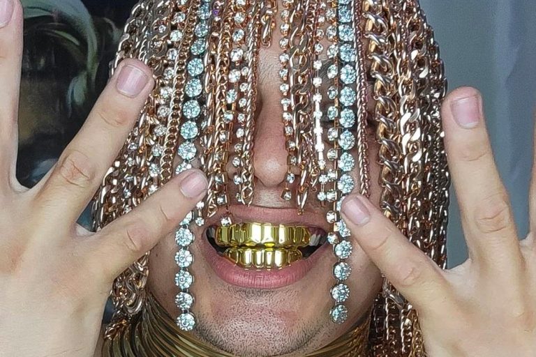 Rapper Ini Tanamkan Perhiasan ke Dalam Kulit Kepalanya